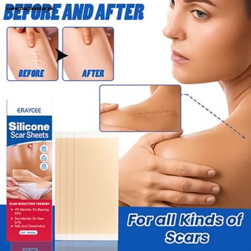 Deramed Silicone Sheet For Treatment