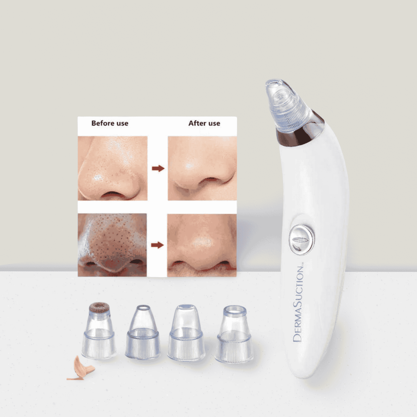 4 in 1 High Quality Black Head Remover Derma Suction - Shop Online