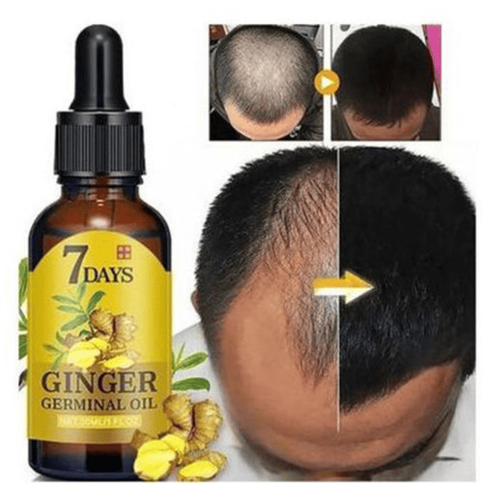 7 Days Ginger Germinal Oil - Shop Online Pakistan
