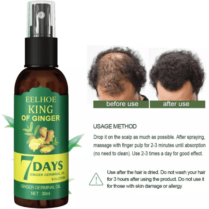 7 Days Spray Hair Growth Germinal Serum Oil - Shop Online Pakistan