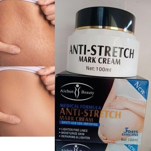 Aichun Beauty Anti Stretch Marks Cream - Shop Online Pakistan