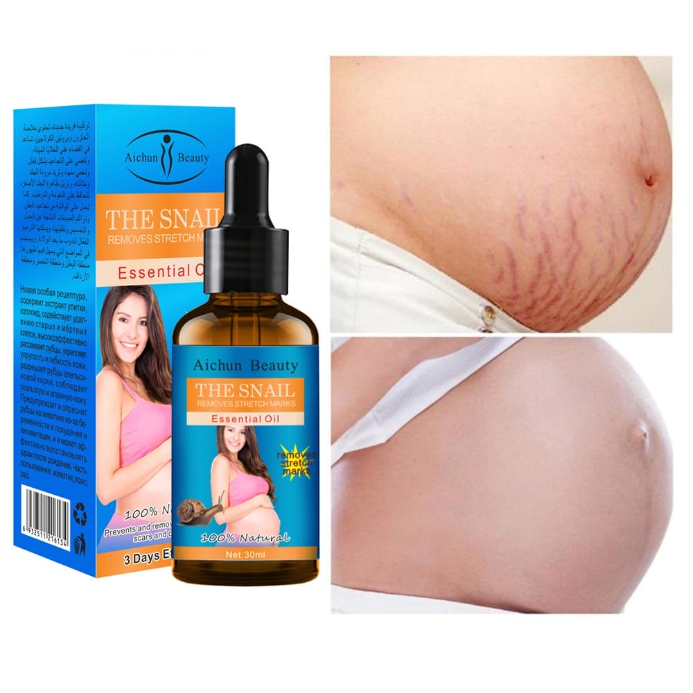 Aichun Beauty Natural Snail Extract Skin Care Repair Treatment Stretch Marks Oil - Shop Online Pakistan