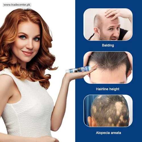Alopecia Hair Growth Cream - Shop Online Pakistan
