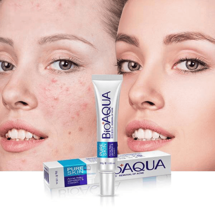 BIOAQUA Acne Anti-Wrinkle Removal Cream - Shop Online Pakistan