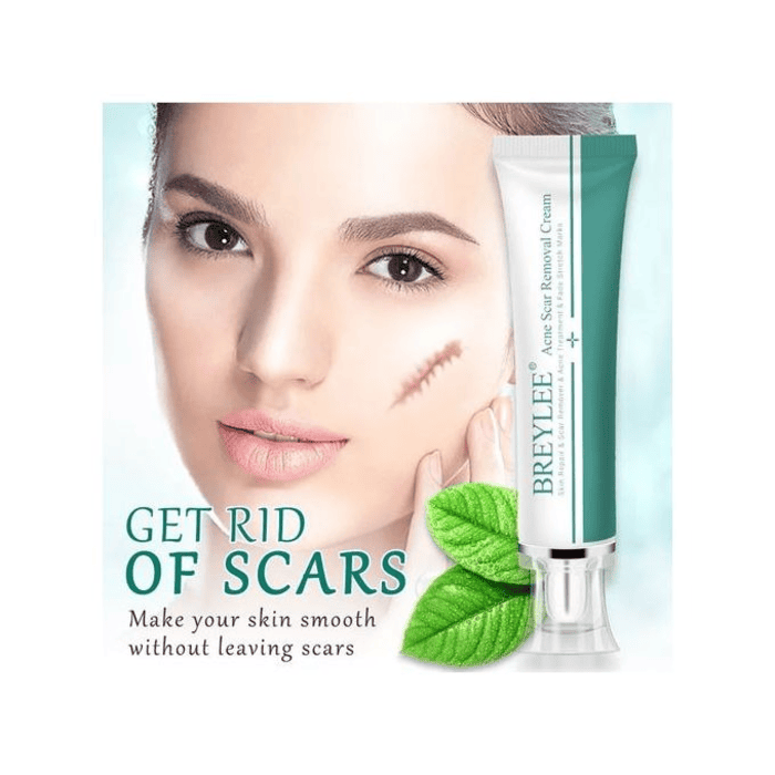 Breylee Acne Scar Removal Cream - Shop Online Pakistan