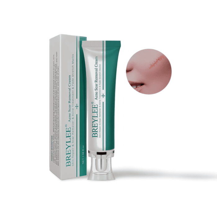 Breylee Acne Scar Removal Cream - Shop Online Pakistan