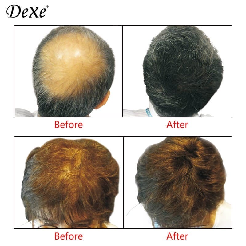 Dexe Hair Building Fibers - Shop Online Pakistan