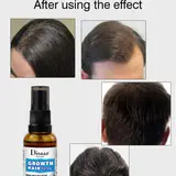 Disaar Hair Care Growth Hair Spray – gallery image