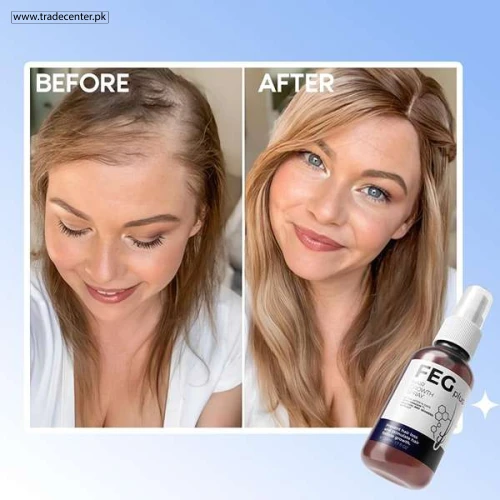 Feg Plus Hair Growth Spray Price In Pakistan | Order Now - Shop Online Pakistan Feg Plus Hair Growth Spray - Shop Online Pakistan