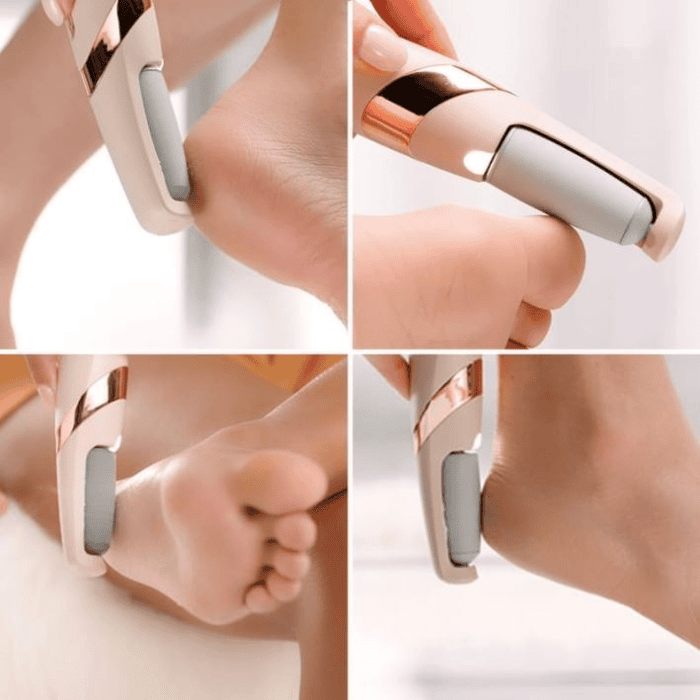 Find Back Electric Pedi Callous Remover - Shop Online Pakistan