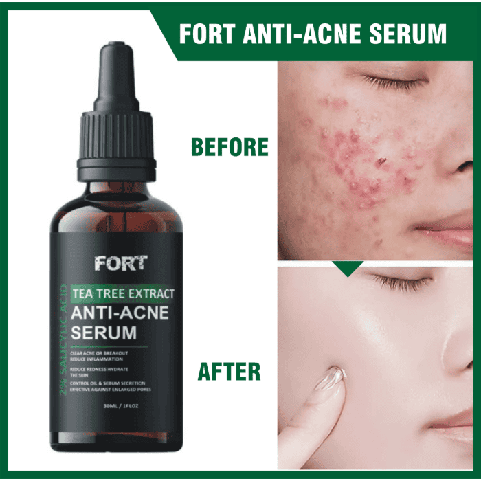 Fort Salicylic Acid Serum - Shop Online Pakistan