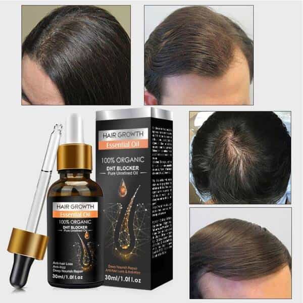 Hair Growth Essential Oil - Shop Online