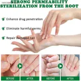 Nail Fungal Treatment Serum – gallery image