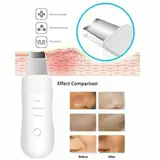 Peeling Machine Ultrasonic Facial Skin Scrubber – gallery image