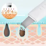 Peeling Machine Ultrasonic Facial Skin Scrubber – gallery image