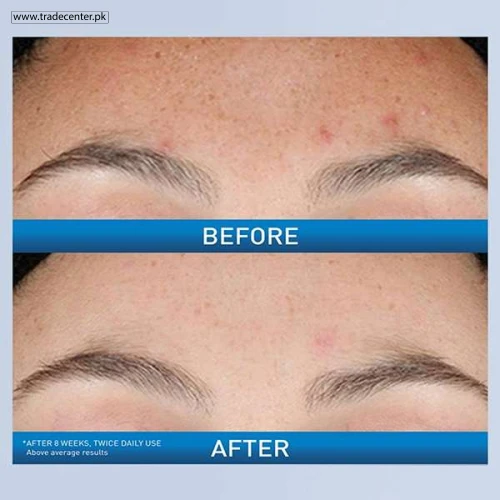 Resurfacing Retinol Serum 30ml - Shop Online Pakistan