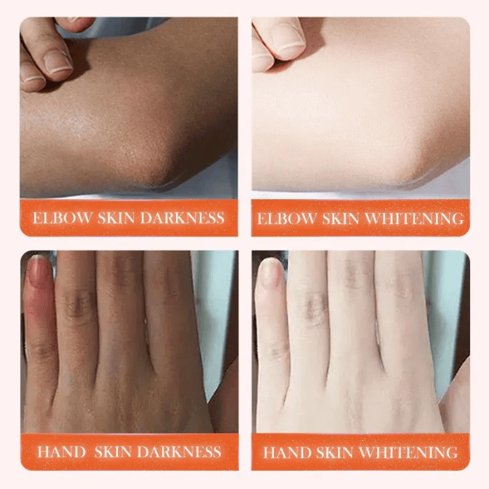 Sadoer Whitening Dark Knuckle Serum - Shop Online Pakistan