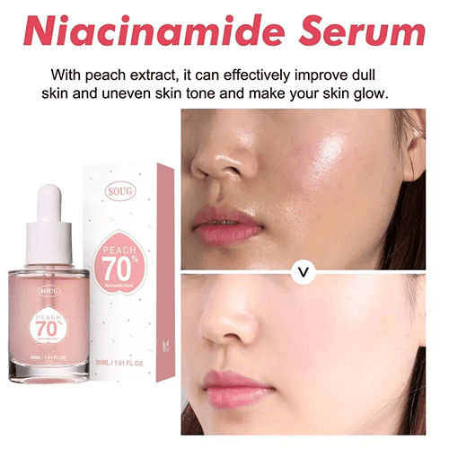 Soug Peach 70% Niacinamide Serum - Shop Online Pakistan