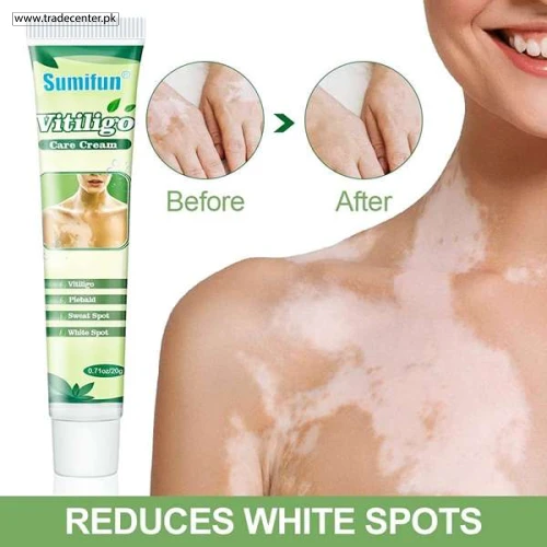 Sumifun Vitiligo White Spot Removal - Shop Online Pakistan