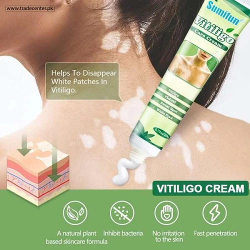 Sumifun Vitiligo White Spot Removal - Shop Online Pakistan