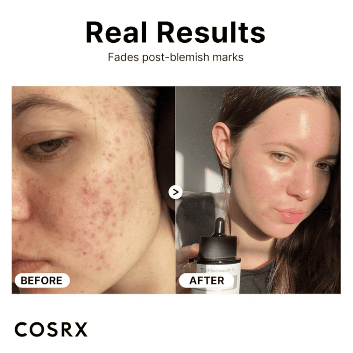 The Niacinamide Face Serum - Shop Online Pakistan