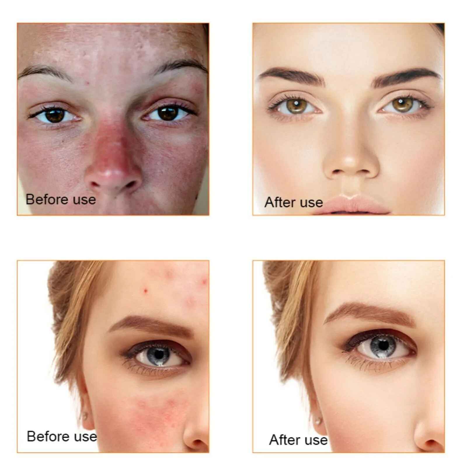 Trstay Vitamin C Whitening Face Serum - Shop Online Pakistan
