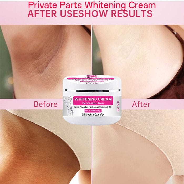 Whitening Cream For Sensitive Areas - Shop Online Pakistan